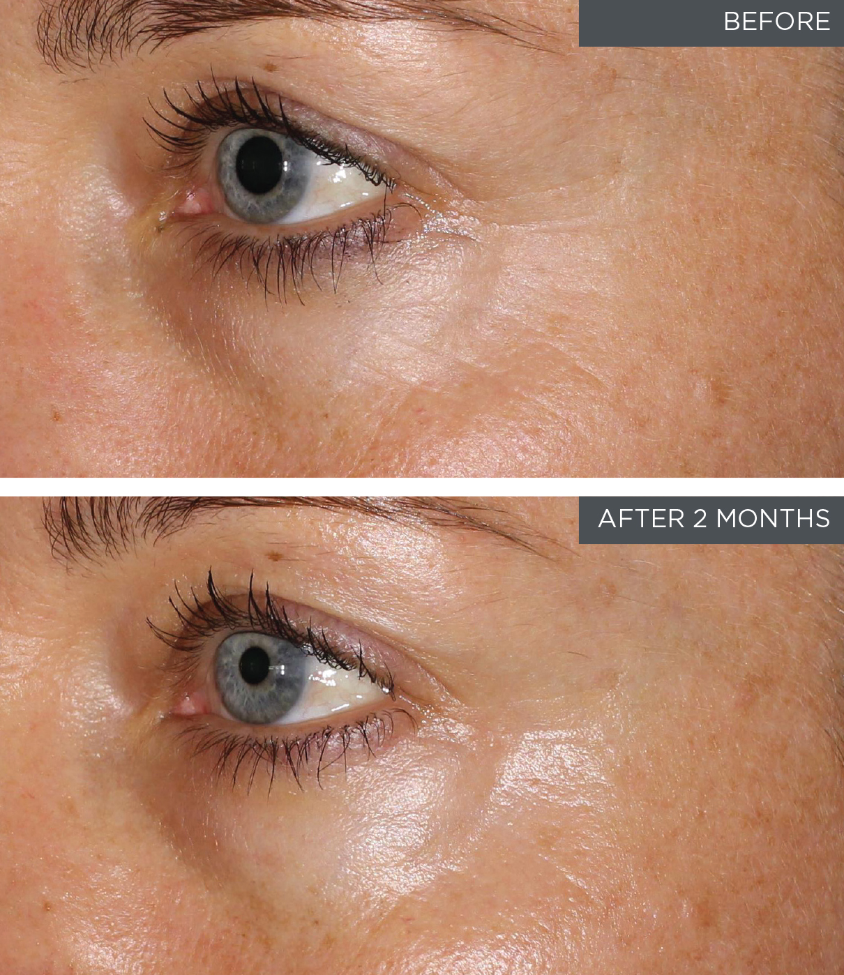 Environ Before & After Photos - Pure Skin Care